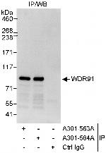 WDR91 Antibody in Immunoprecipitation (IP)
