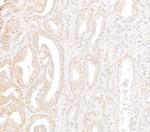 WDR91 Antibody in Immunohistochemistry (Paraffin) (IHC (P))