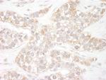 Flightless-1 Polyclonal Antibody
