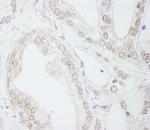 METTL3/MT-A70 Polyclonal Antibody