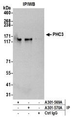 PHC3 Antibody in Immunoprecipitation (IP)