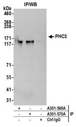 PHC3 Antibody in Immunoprecipitation (IP)
