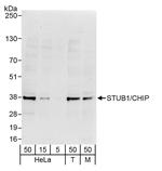 STUB1/CHIP Polyclonal Antibody