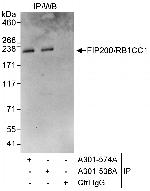 FIP200/RB1CC1 Polyclonal Antibody