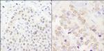 CPSF100 Polyclonal Antibody