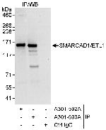 SMARCAD1/ETL1 Polyclonal Antibody