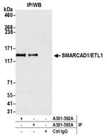 SMARCAD1/ETL1 Antibody in Immunoprecipitation (IP)