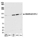 SMARCAD1/ETL1 Polyclonal Antibody