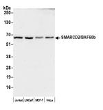 SMARCD2/BAF60b Polyclonal Antibody