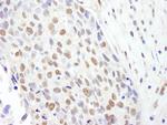 SF3b145/SAP145 Polyclonal Antibody