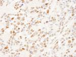 SFRS14 Polyclonal Antibody