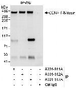 CENP-F/Mitosin Antibody in Immunoprecipitation (IP)