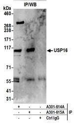 USP16 Antibody in Immunoprecipitation (IP)