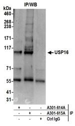 USP16 Polyclonal Antibody