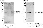 SMARCAL1 Antibody in Western Blot (WB)