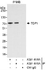 TDP1 Polyclonal Antibody