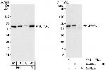 KPNA3 Antibody in Western Blot (WB)