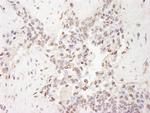 MBD2 Polyclonal Antibody
