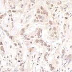 Pol Lambda Polyclonal Antibody