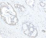 EHMT1 Polyclonal Antibody