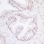MAZ/SAF-1 Antibody in Immunohistochemistry (Paraffin) (IHC (P))