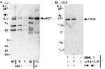 APC1 Antibody in Western Blot (WB)