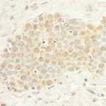 WDR20 Antibody in Immunohistochemistry (Paraffin) (IHC (P))
