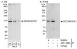 DDX26/DICE1 Antibody in Western Blot (WB)