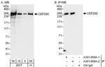 CEP290 Antibody in Western Blot (WB)