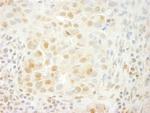 PRPF4B Antibody in Immunohistochemistry (Paraffin) (IHC (P))
