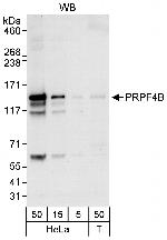 PRPF4B Antibody in Western Blot (WB)