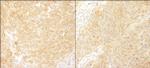 BCAR1/p130CAS Antibody in Immunohistochemistry (Paraffin) (IHC (P))