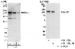 BCoR Polyclonal Antibody