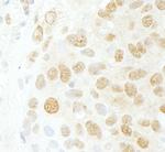 CDC5L Polyclonal Antibody