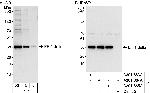 EF-1 delta Polyclonal Antibody