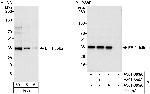 EF-1 delta Polyclonal Antibody