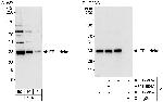 EF-1 delta Polyclonal Antibody