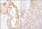 eEF2 Kinase Polyclonal Antibody