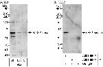 eEF2 Kinase Antibody in Western Blot (WB)