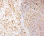 eEF2 Polyclonal Antibody