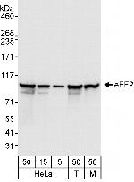 eEF2 Antibody in Western Blot (WB)