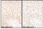 BMI1 Polyclonal Antibody