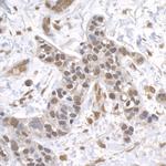 USP1 Polyclonal Antibody