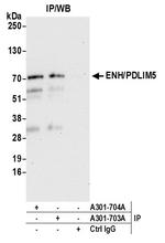 ENH/PDLIM5 Polyclonal Antibody