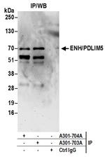 ENH/PDLIM5 Antibody in Immunoprecipitation (IP)