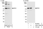 RED Antibody in Western Blot (WB)