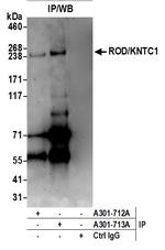ROD/KNTC1 Antibody in Immunoprecipitation (IP)