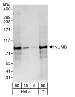 NUMB Polyclonal Antibody