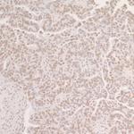 OCT1 Antibody in Immunohistochemistry (Paraffin) (IHC (P))