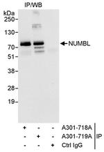 NUMBL Polyclonal Antibody